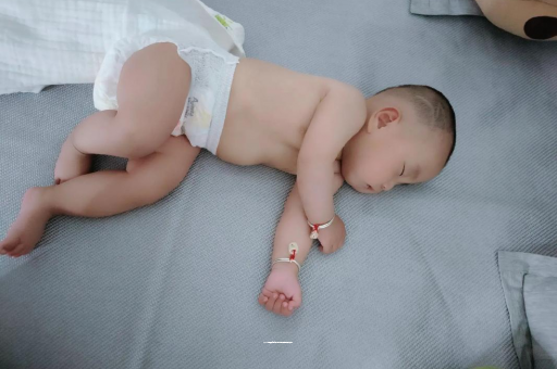 蓬莱六个月宝宝眼睛散光